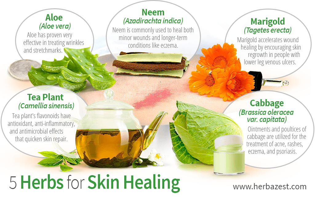 5 Herbs For Skin Healing HerbaZest